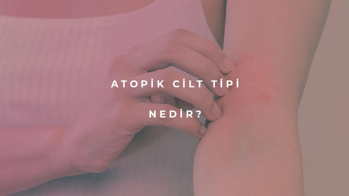 Atopik Cilt Tipi Nedir?