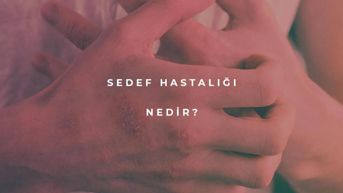 Sedef Hastalığı Nedir?